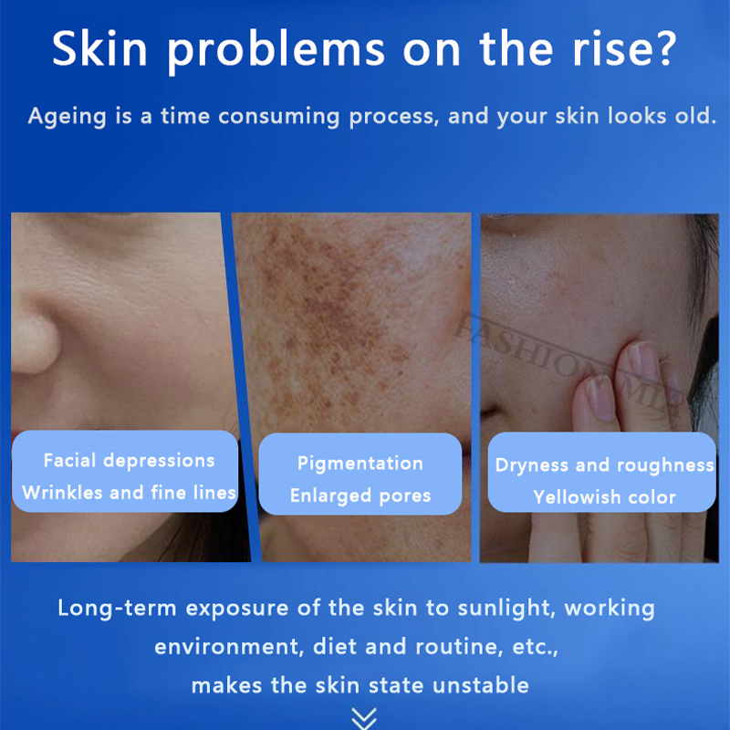 80% Blue Sponge microalgae Kit – Skincare Collagen recenzja i cena
